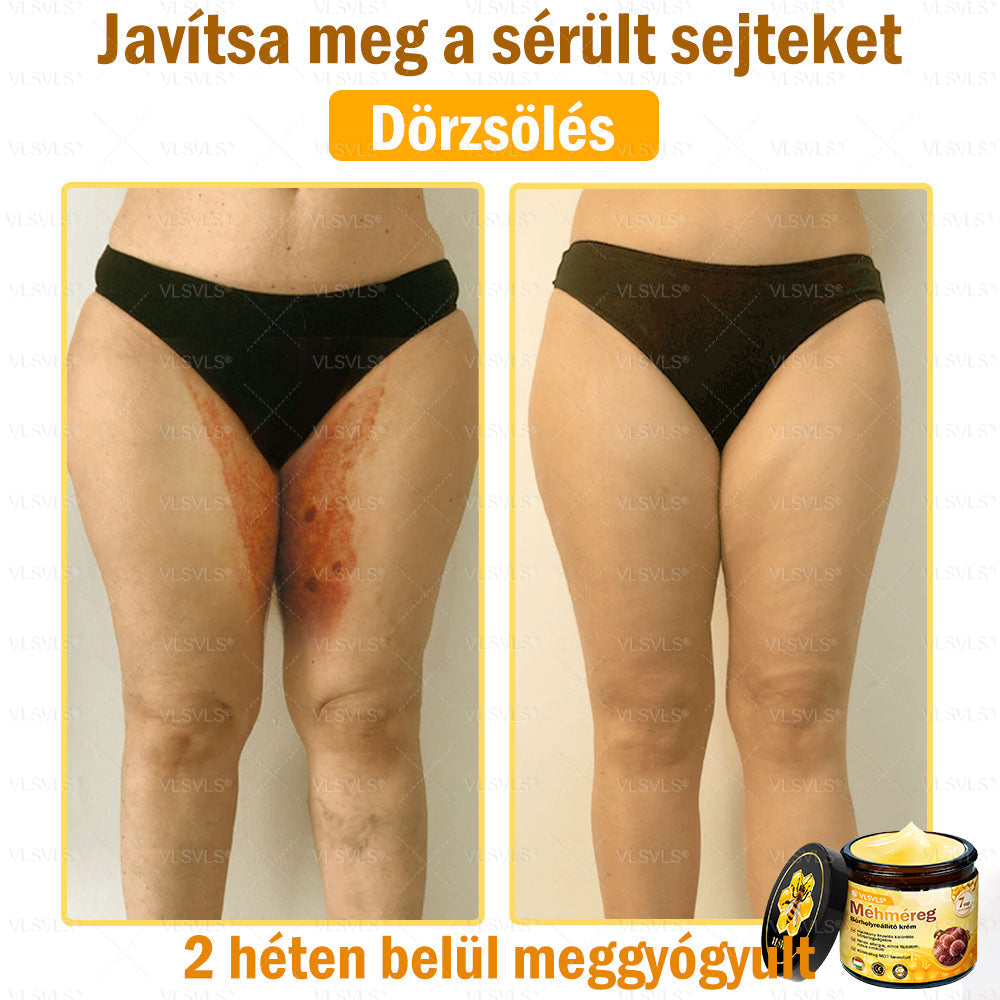 👍💪VLSVLS® Méhméreg Bőrhelyreállító Krém (👨‍⚕‍CE jóváhagyott)✅