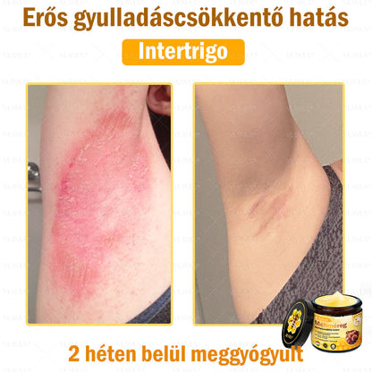 👍💪VLSVLS® Méhméreg Bőrhelyreállító Krém (👨‍⚕‍CE jóváhagyott)✅