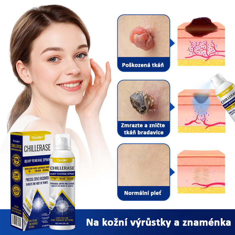 Timilk® ChillErase pattanásmegújító spray