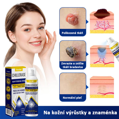 Timilk® ChillErase pattanásmegújító spray