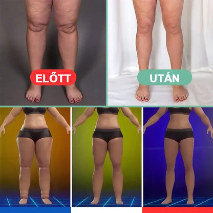 🔥💆Elektronikus limfavizeletű és cellulitisellenes masszírozó eszköz