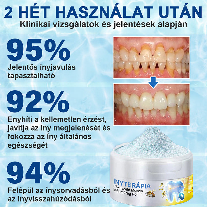 🇭🇺 Furzero® 𝑭𝒐𝒄𝒖𝒔𝒔𝒎𝒊𝒍𝒆 – Méhméreges szájápoló por 🦷🦷🦷