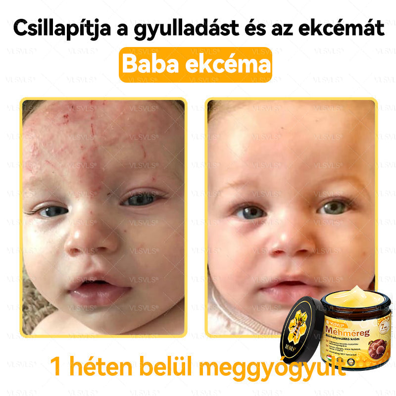 👍💪VLSVLS® Méhméreg Bőrhelyreállító Krém (👨‍⚕‍CE jóváhagyott)✅