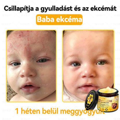 👍💪VLSVLS® Méhméreg Bőrhelyreállító Krém (👨‍⚕‍CE jóváhagyott)✅