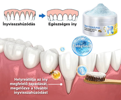 🇭🇺 Furzero® 𝑭𝒐𝒄𝒖𝒔𝒔𝒎𝒊𝒍𝒆 – Méhméreges szájápoló por 🦷🦷🦷